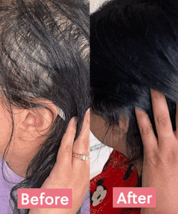 Hair Growth Oil Spray - ForChics Australia